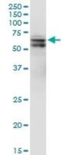 PDK-1 Antibody (2E2), Novus Biologicals 0.1 mg | Buy Online | Novus Biologicals | Fisher Scientific