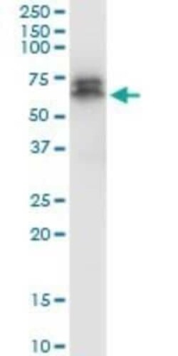 PDK-1 Antibody (2E2), Novus Biologicals 0.1 mg | Buy Online | Novus Biologicals | Fisher Scientific