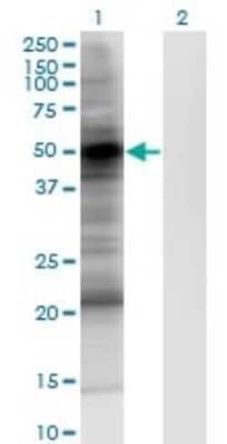 PDK-1 Antibody (2E2), Novus Biologicals 0.1 mg | Buy Online | Novus Biologicals | Fisher Scientific