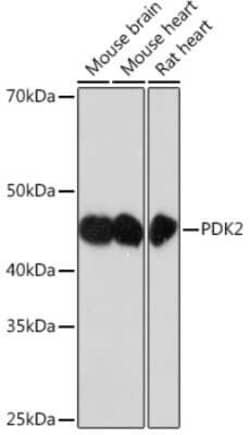 PDK2 Rabbit anti-Human, Mouse, Rat, Clone: 7X6R7, Novus Biologicals 100 &mu;g | Buy Online | Novus Biologicals | Fisher Scientific