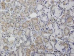 Novus Biologicals PDK2 Antibody (2G1), Novus Biologicals 0.1 mg | Buy Online | Novus Biologicals&trade; | Fisher Scientific