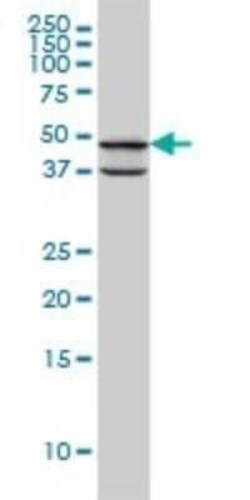 PDK3 Antibody (2B11), Novus Biologicals 0.1 mg | Buy Online | Novus Biologicals | Fisher Scientific