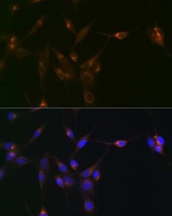 PDLIM1 Rabbit anti-Human, Mouse, Rat, Clone: 5X10L2, Novus Biologicals 100 &mu;g | Buy Online | Bio-Techne | Fisher Scientific