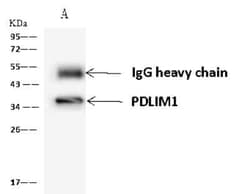 PDLIM1 Antibody, Novus Biologicals 100 &mu;g, Unconjugated:Antibodies,