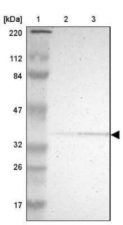 PDLIM2 Antibody, Novus Biologicals 0.1 mL; Unconjugated:Antibodies, Polyclonal