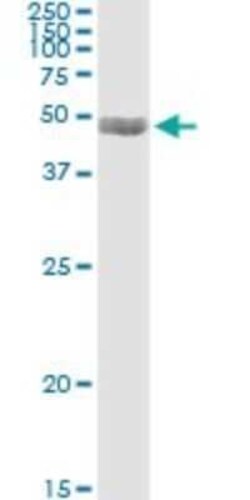 PDLIM7 Antibody (2D6), Novus Biologicals 0.1 mg | Buy Online | Novus Biologicals | Fisher Scientific