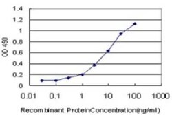 PDLIM7 Antibody (2D6), Novus Biologicals 0.1 mg | Buy Online | Novus Biologicals | Fisher Scientific