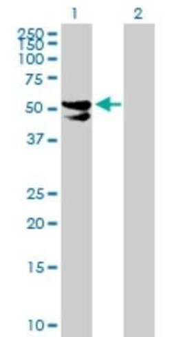 PDP2 Antibody, Novus Biologicals 0.05 mg; Unconjugated:Antibodies, Polyclonal