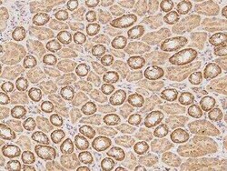 PDP3 Antibody, Novus Biologicals:Anticuerpos:Anticuerpos primarios