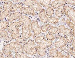 PDSS2 Antibody, Novus Biologicals 50 &mu;g; Unconjugated:Antibodies, Polyclonal