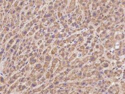 PDSS2 Antibody, Novus Biologicals 50 &mu;g; Unconjugated:Antibodies, Polyclonal