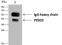 PDSS2 Antibody, Novus Biologicals 50 &mu;g; Unconjugated:Antibodies, Polyclonal