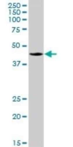 PDSS2 Antibody, Novus Biologicals 50 &mu;g; Unconjugated:Antibodies, Polyclonal
