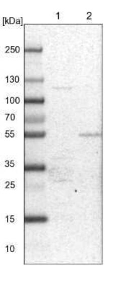 PDSS2 Antibody, Novus Biologicals 0.1 mL; Unconjugated:Antibodies, Polyclonal