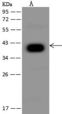 PDSS2 Antibody, Novus Biologicals 50 &mu;g; Unconjugated:Antibodies, Polyclonal