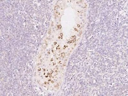 PDXDC1 Antibody, Novus Biologicals 50 &mu;g | Buy Online | Novus Biologicals | Fisher Scientific