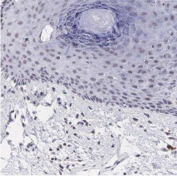 PDXP Antibody, Novus Biologicals:Antibodies:Primary Antibodies