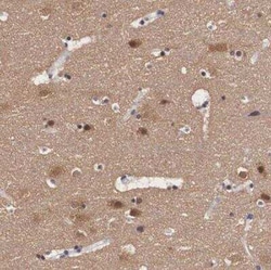 PDXP Antibody, Novus Biologicals:Antibodies:Primary Antibodies