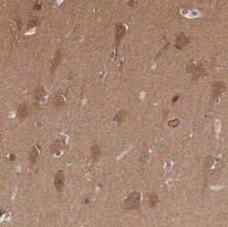 PDXP Antibody, Novus Biologicals:Antibodies:Primary Antibodies