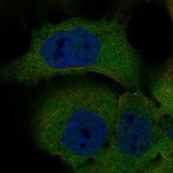 PDZD2/PDZK3 Rabbit anti-Human, Polyclonal, Novus Biologicals:Antibodies:Primary