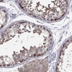PDZD2/PDZK3 Rabbit anti-Human, Polyclonal, Novus Biologicals:Antibodies:Primary
