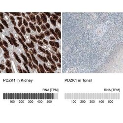 PDZK1 Antibody, Novus Biologicals 25 &mu;L | Buy Online | Novus Biologicals | Fisher Scientific