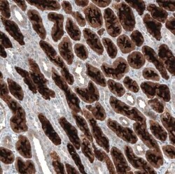 PDZK1 Antibody, Novus Biologicals 25 &mu;L | Buy Online | Novus Biologicals | Fisher Scientific