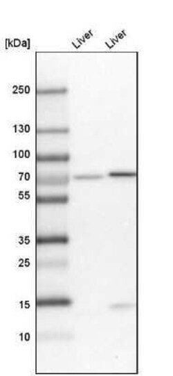 PDZK1 Antibody, Novus Biologicals 25 &mu;L | Buy Online | Novus Biologicals | Fisher Scientific