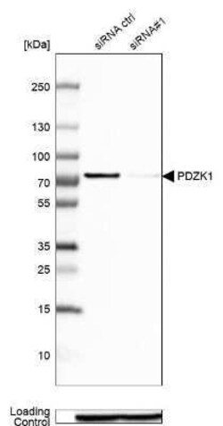 PDZK1 Antibody, Novus Biologicals 25 &mu;L | Buy Online | Novus Biologicals | Fisher Scientific