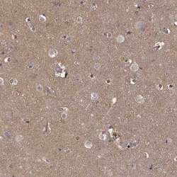 PEA-15 Antibody, Novus Biologicals:Antibodies:Primary Antibodies