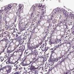 PEA-15 Antibody, Novus Biologicals:Antibodies:Primary Antibodies