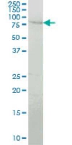 PEAK1 Antibody (1G9), Novus Biologicals 0.1 mg; Unconjugated:Antibodies,