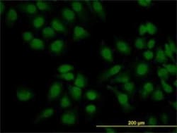 PEAK1 Antibody (3E7), Novus Biologicals 0.1 mg | Buy Online | Novus Biologicals | Fisher Scientific