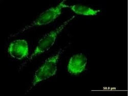 PECI Antibody, Novus Biologicals 0.05 mg | Buy Online | Novus Biologicals | Fisher Scientific