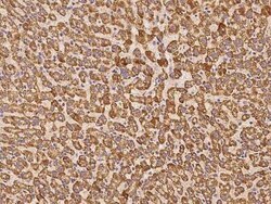 PECR Antibody, Novus Biologicals 100 &mu;g, Unconjugated:Antibodies, Polyclonal