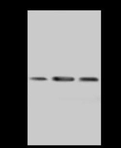 PECR Antibody, Novus Biologicals 100 &mu;g, Unconjugated:Antibodies, Polyclonal