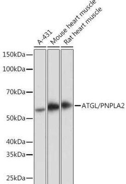 PEDFR/PNPLA2/ATGL Rabbit anti-Human, Mouse, Rat, Clone: 10Y4M10, Novus