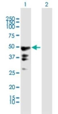 Novus Biologicals PEG10 Antibody, Novus Biologicals 50 &mu;g | Buy Online | Novus Biologicals&trade; | Fisher Scientific