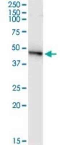 PELO Antibody (2C2), Novus Biologicals 0.1 mg | Buy Online | Novus Biologicals | Fisher Scientific