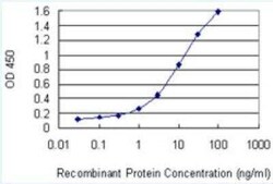 PELP1 Antibody (1F7), Novus Biologicals 100 &mu;g | Buy Online | Novus Biologicals | Fisher Scientific