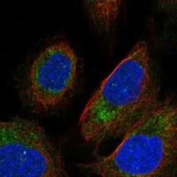 PEMT Rabbit anti-Human, Polyclonal, Novus Biologicals:Antibodies:Primary