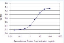 PERK Antibody (7B10), Novus Biologicals 100 &mu;g | Buy Online | Novus Biologicals | Fisher Scientific