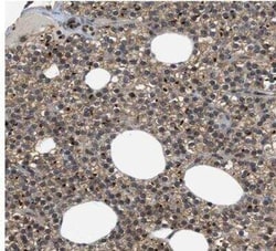 PERK Antibody, Novus Biologicals 25 &mu;L; Unconjugated:Antibodies, Polyclonal