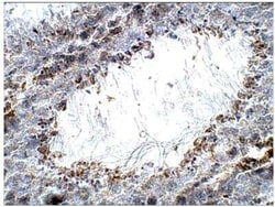 PERK Antibody, Novus Biologicals 100 &mu;g; Unconjugated:Antibodies, Polyclonal