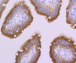 PERP Rabbit anti-Human, Mouse, Clone: JU04-51, Novus Biologicals 100 &mu;l;