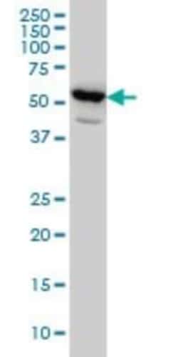 Novus Biologicals PET112L Antibody (6B2), Novus Biologicals 0.1 mg | Buy Online | Novus Biologicals&trade; | Fisher Scientific