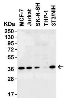 PEX10 Antibody - BSA Free, Novus Biologicals 0.1 mg; Unconjugated:Antibodies,