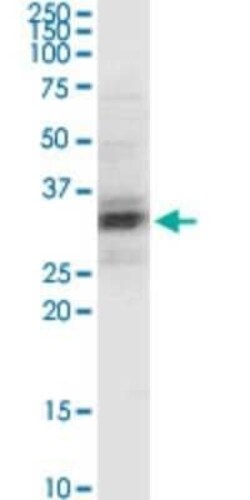 PEX11A Antibody (3B1), Novus Biologicals 0.1 mg | Buy Online | Novus Biologicals | Fisher Scientific
