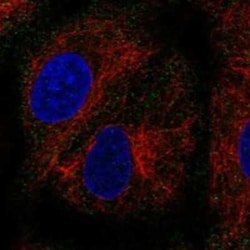 PEX11B Rabbit anti-Human, Polyclonal, Novus Biologicals 25 &mu;g; Unconjugated:Antibodies,