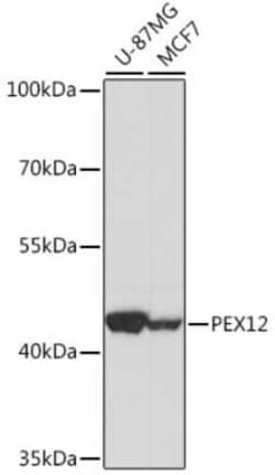 PEX12 Antibody - Azide and BSA Free, Novus Biologicals 0.02 mL; Unconjugated:Antibodies,
